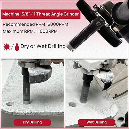 Diamond Core Drill Bit - FOCSTOL 1''(25mm) Laser Welded Hole Saw for Dry or Wet Drilling Granite Marble Concrete Quartz 5/8''-11 Thread